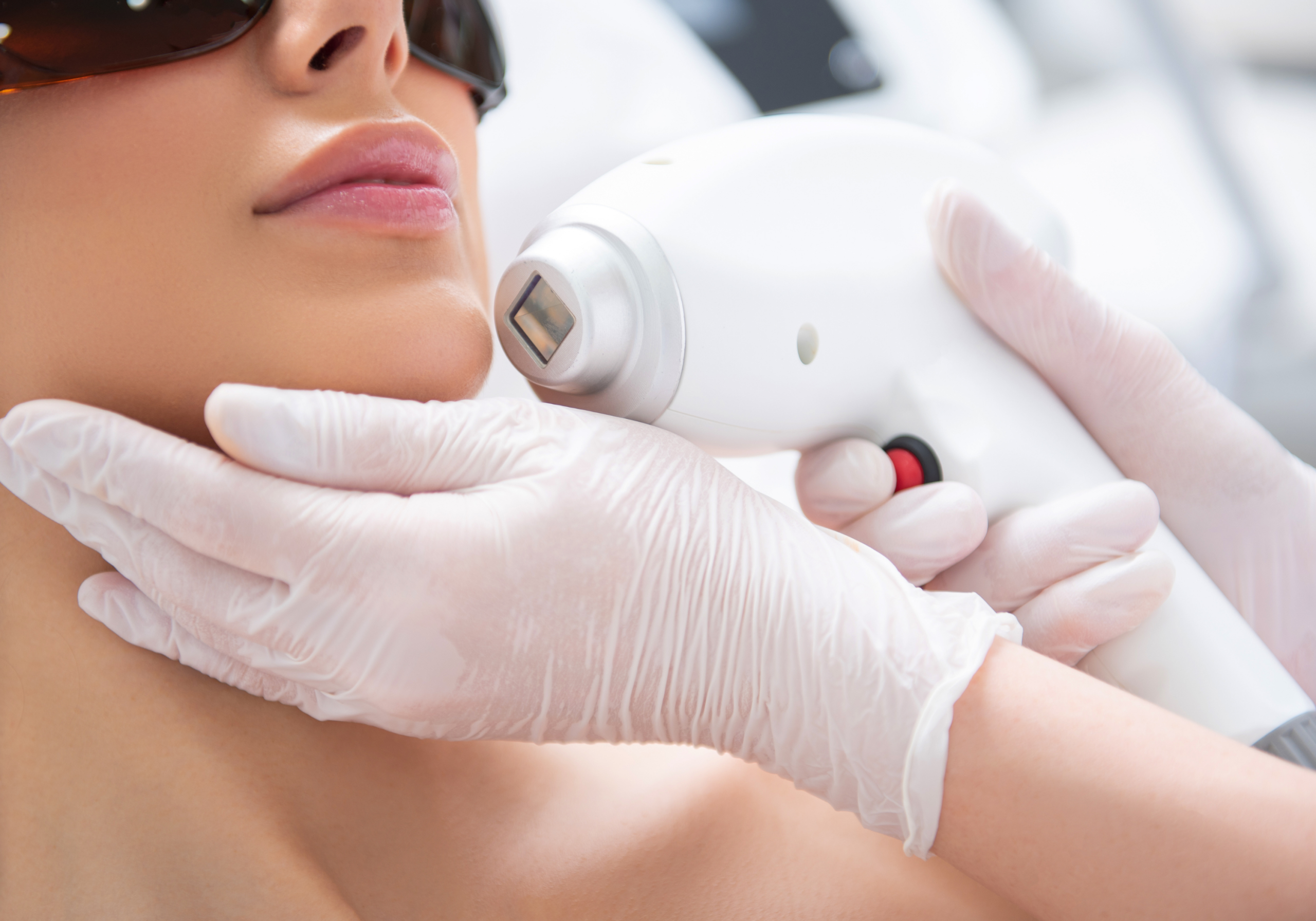 Laser Haarentfernung Zielzonen für Frauen Kosmetikstudio Bielefeld